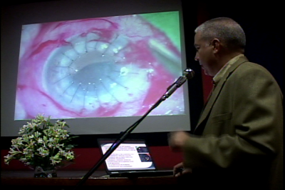Primer  encuentro  provincial  de glaucomatólogos de Villa Clara.